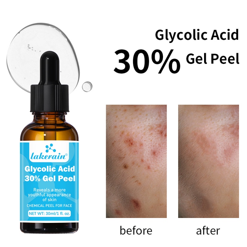 Lactic Acid Toner - 30% جل تقشير حمض الجليكوليك درجة