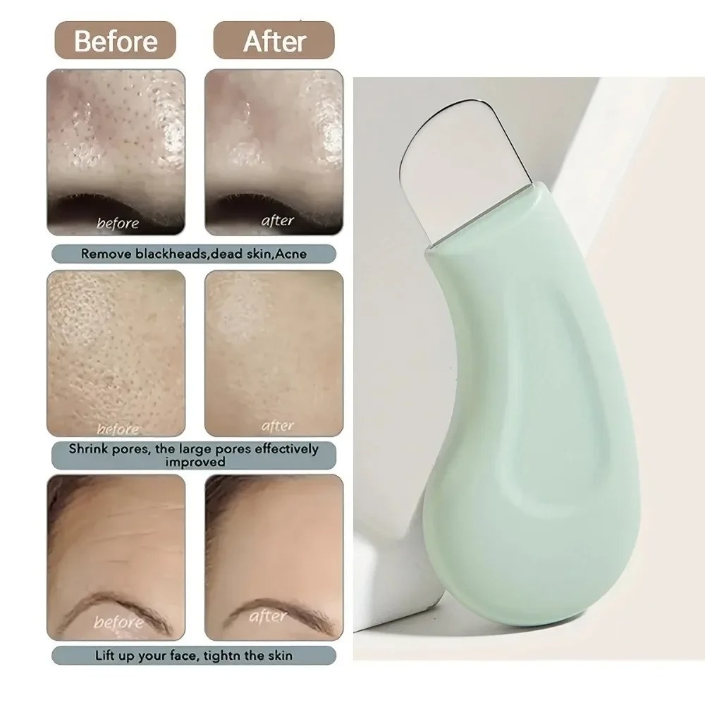 أداة تنظيف عميق لإزالة الرؤوس  - مراجعة Skincare Routine وسعره