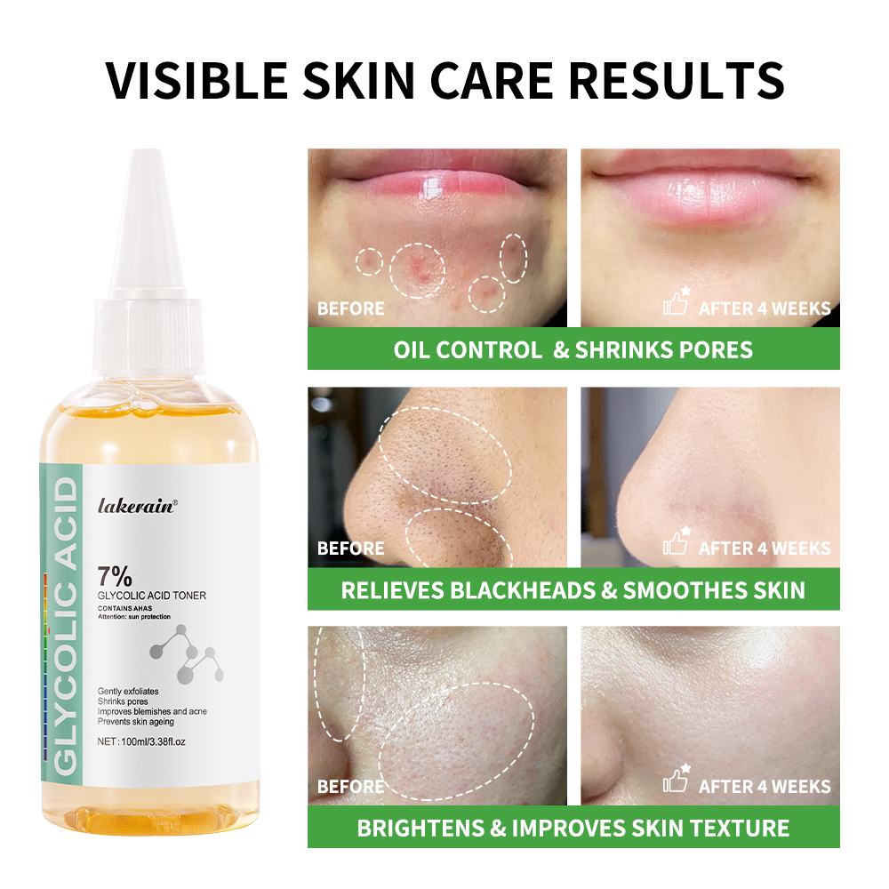 جلايكوليك للعناية ببشرة الوجه  - مراجعة Lactic Acid Toner وسعره
