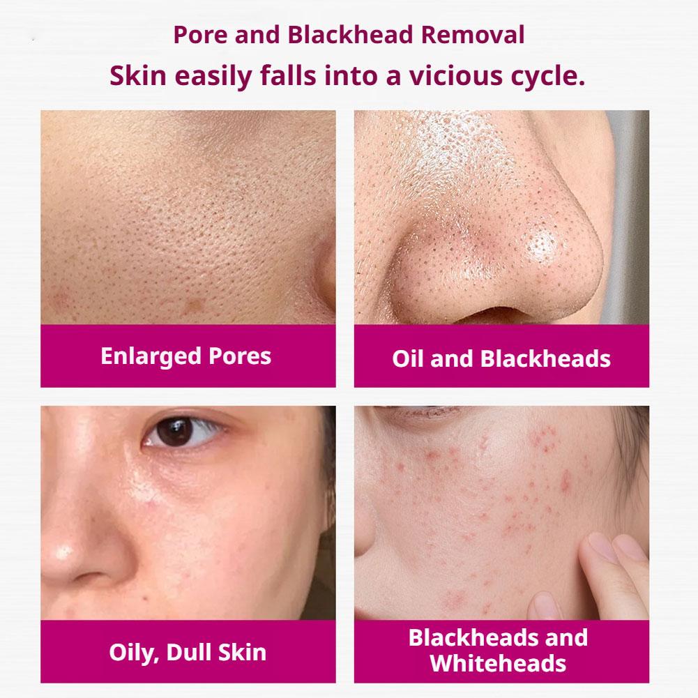 سيروم حمض الساليسيليك لتقليص ا - مراجعة Azelaic Acid Serum وسعره