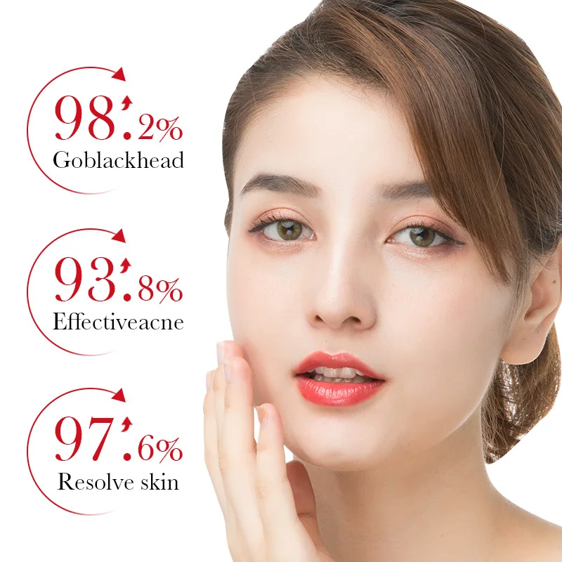 BIOAQUA حمض الساليسيليك حب الش - مراجعة Azelaic Acid Serum وسعره