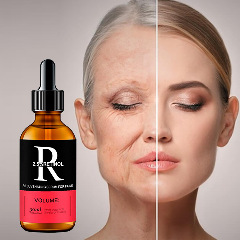 مصل العناية بالبشرة للوجه فيتا - مراجعة Azelaic Acid Serum وسعره